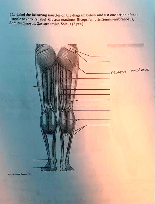 11. Label the following muscles on the diagram below and