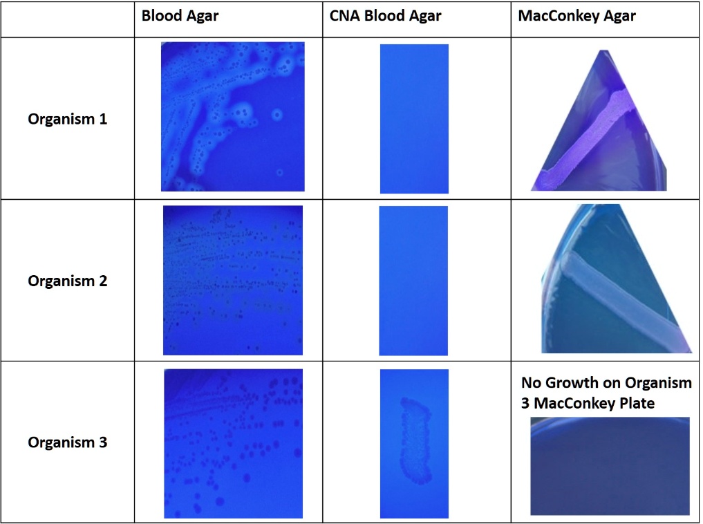 Normal Blood Gar SOLVED: Blood Agar CNA Blood Agar MacConkey Agar Organism 1 Organism 2 ...