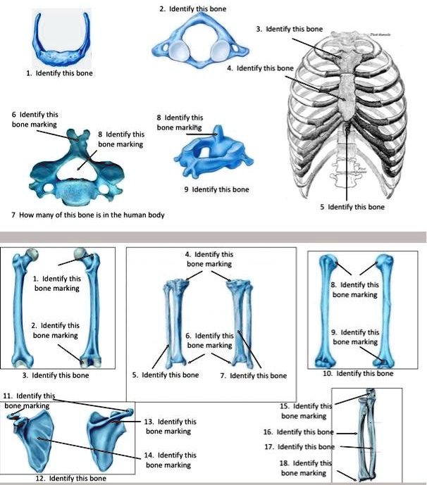 1. Identify this bone 2. Identify this bone 3. Identify this...