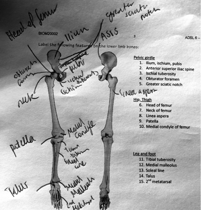 Head of femur
Ilium
ASIS
Greater sciatic notch
Label the following features on the lower limb bones:
Pelvic girdle
1. Ilium, ischium, pubis
2. Anterior superior iliac spine
3. Ischial tuberosity
4. Obturator foramen
5. Greater sciatic notch
Obturator foramen
Pubis
Ischium
Ischial tuberosity
Neck of femur
Linea aspera
Hip, Thigh
6. Head of femur
7. Neck of femur
8. Linea aspera
9. Patella
10. Medial condyle of femur
Patella
Medial Condyle
Tibial tuberosity
Soleal line
Leg and foot
11. Tibial tuberosity
12. Medial malleolus
13. Soleal line
14. Talus
15. 2nd metatarsal
Talus
Medial Malleolus
2nd metatarsal