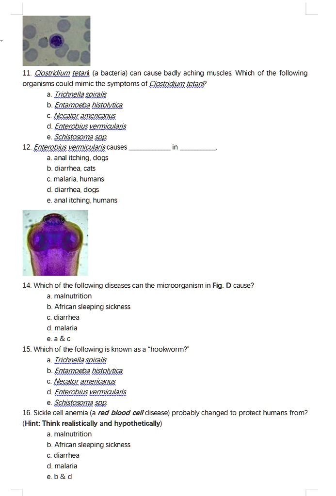 SOLVED: 11. Clostridium tetani (a bacteria) can cause badly aching ...