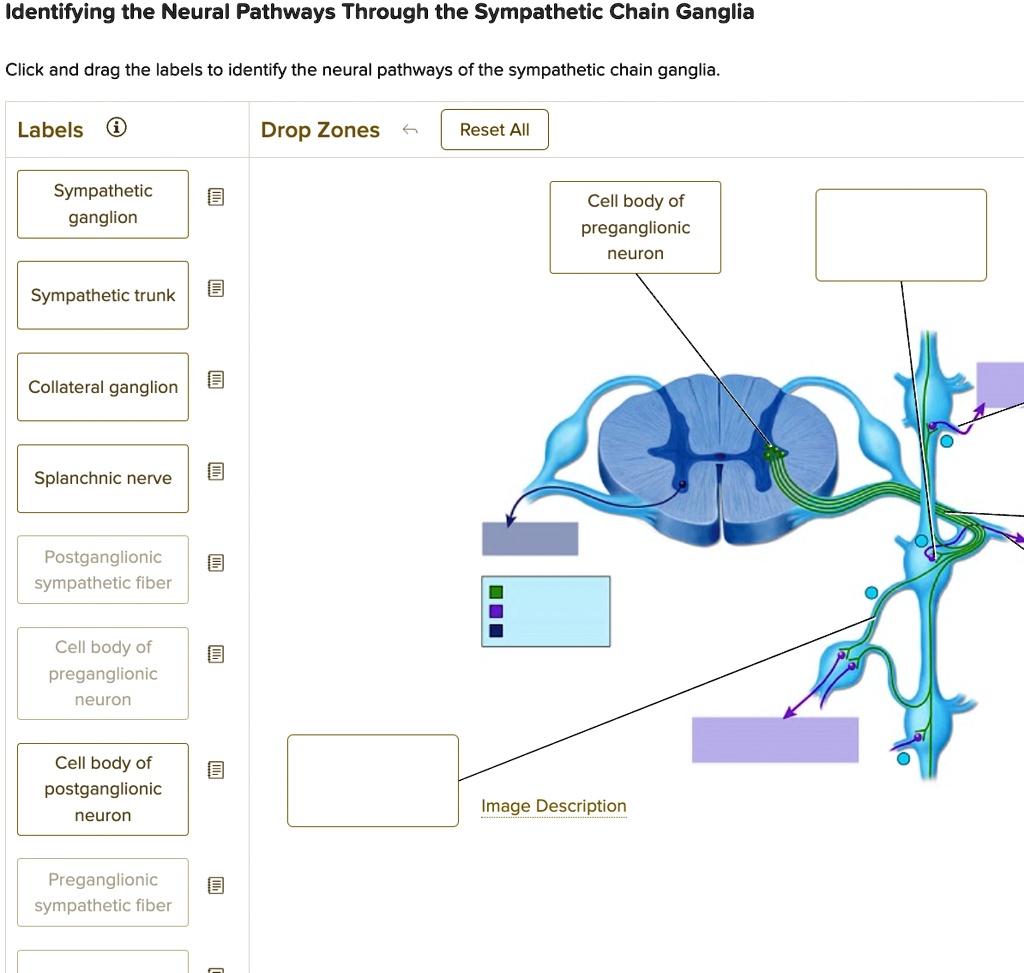 SOLVED: Identifying the Neural Pathways Through the Sympathetic Chain ...