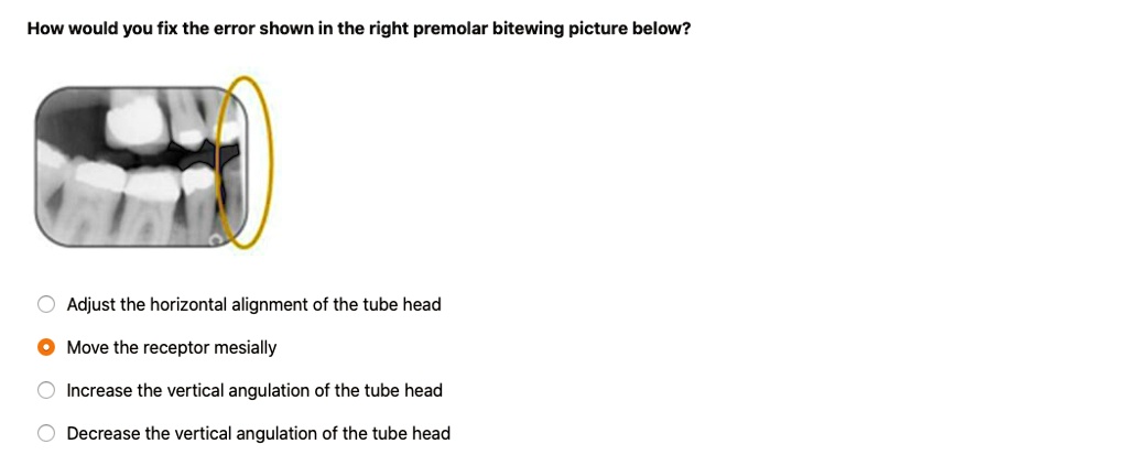How would you fix the error shown in the right premolar bitewing ...