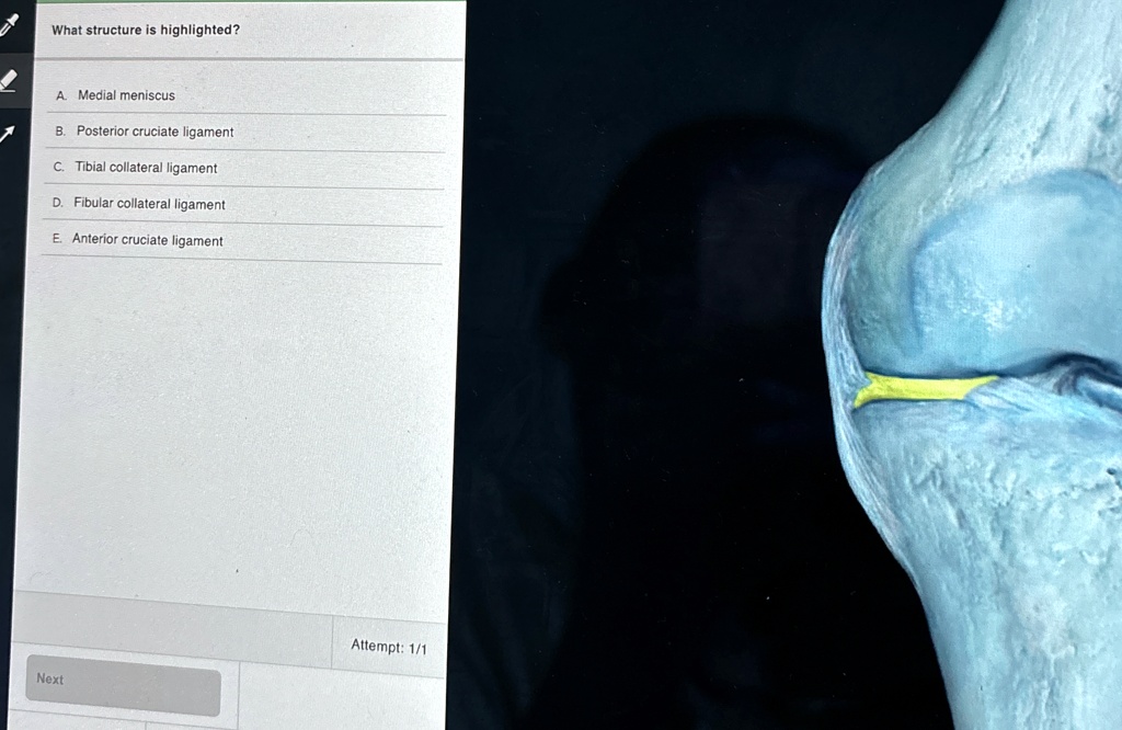 what structure is highlighted a medial meniscus b posterior cruciate ...