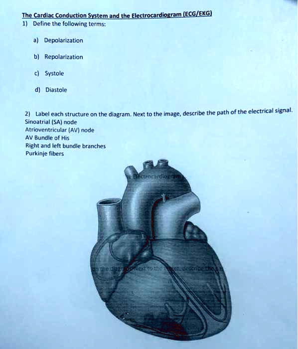 The Cardiac Conduction System and the Electrocardiogram (ECG/EKG)
1) Define the following terms:
a) Depolarization
b) Repolarization
c) Systole
d) Diastole
2) Label each structure on the diagram. Next to the image, describe the path of the electrical signal.
Sinoatrial (SA) node
Atrioventricular (AV) node
AV Bundle of His
Right and left bundle branches
Purkinje fibers