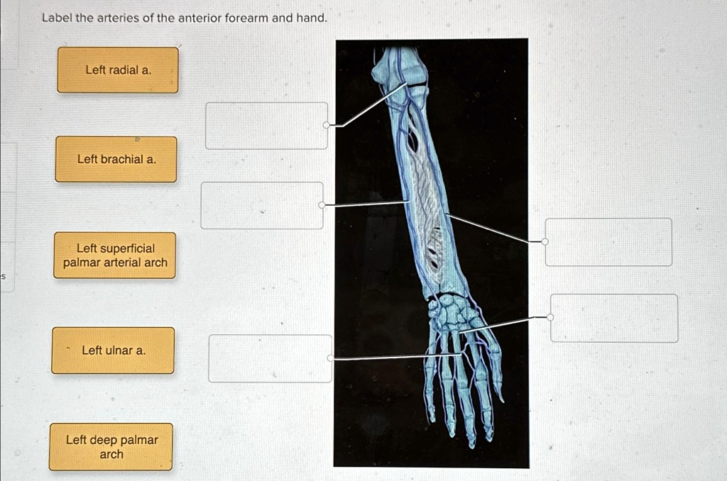 SOLVED: Label the arteries of the anterior forearm and hand. Left