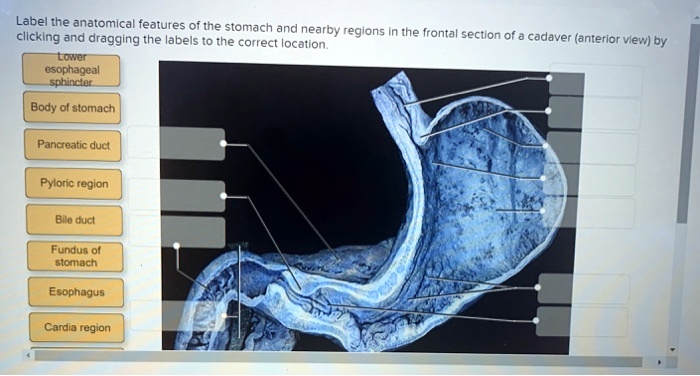 SOLVED: Label The Anatomical Features Of The Stomach And Nearby Regions ...