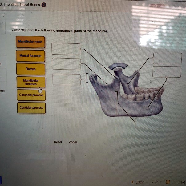 SOLVED: correctly label the following anatomical parts of the mandible ...