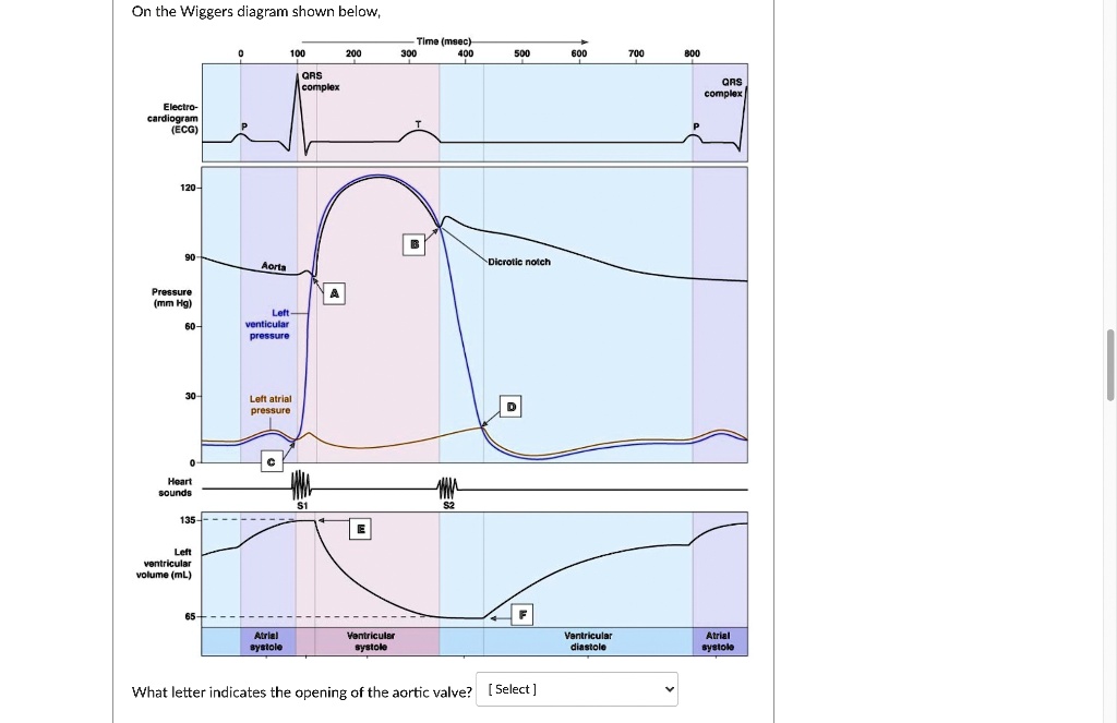 SOLVED: On the Wiggers diagram shown below, Time(msec 300 400 0 100 200 ...