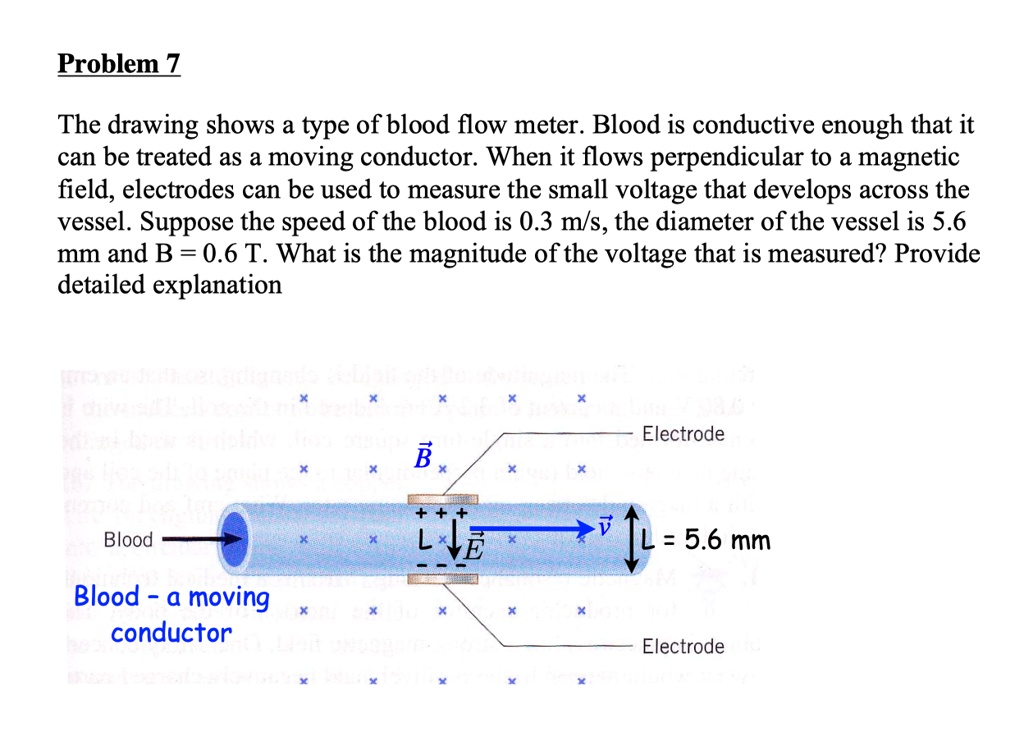 SOLVED The drawing shows a type of blood flow meter. Blood is