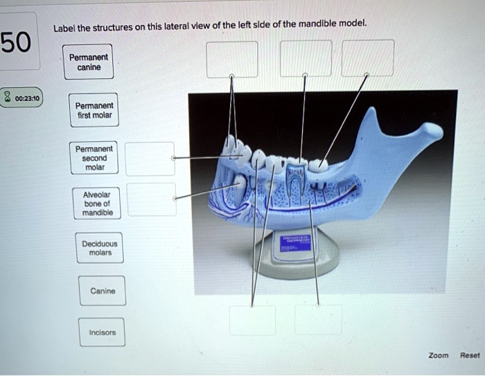 Solved: Label The Structures On This Lateral View Of The Left Side Of 