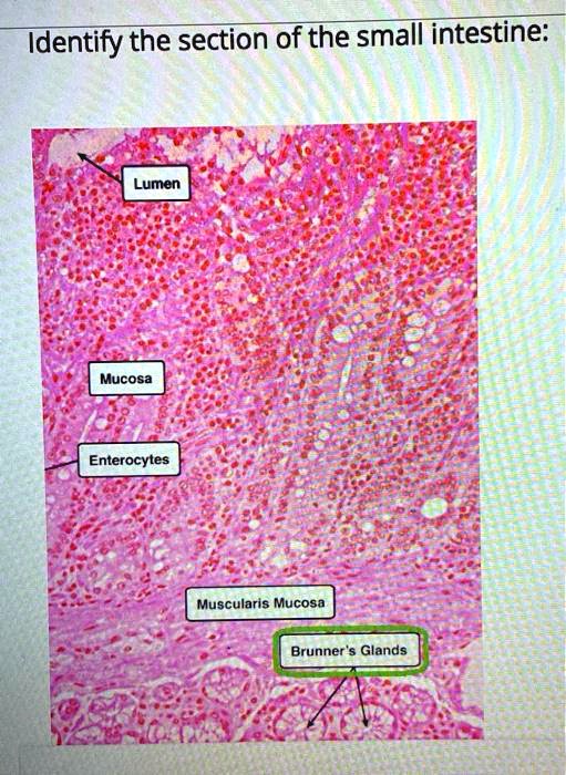 SOLVED: Identify the section of the small intestine: Lumen Mucosa ...