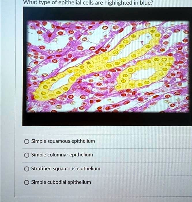 SOLVED What type of epithelial cells are highlighted in blue? Simple