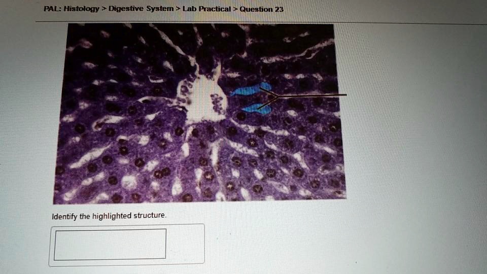 SOLVED: question 23 identify the highlighted structure PALHistology ...