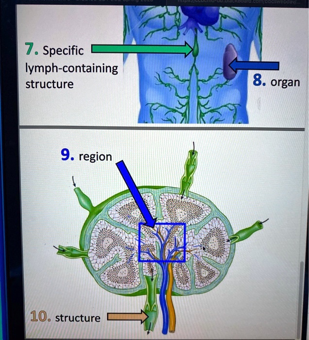 7 specific iymph containing structure 8 organ 9 region 10 structure 82437