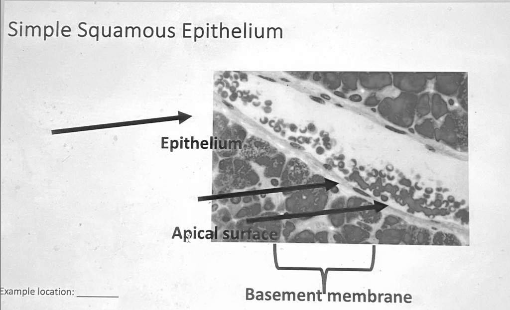 SOLVED Simple Squamous Epithelium Label the image by putting the