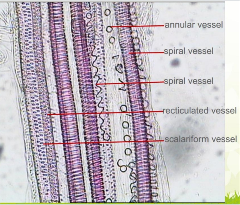 SOLVED annular vessel spiral vessel spiral vessel recticulated vessel