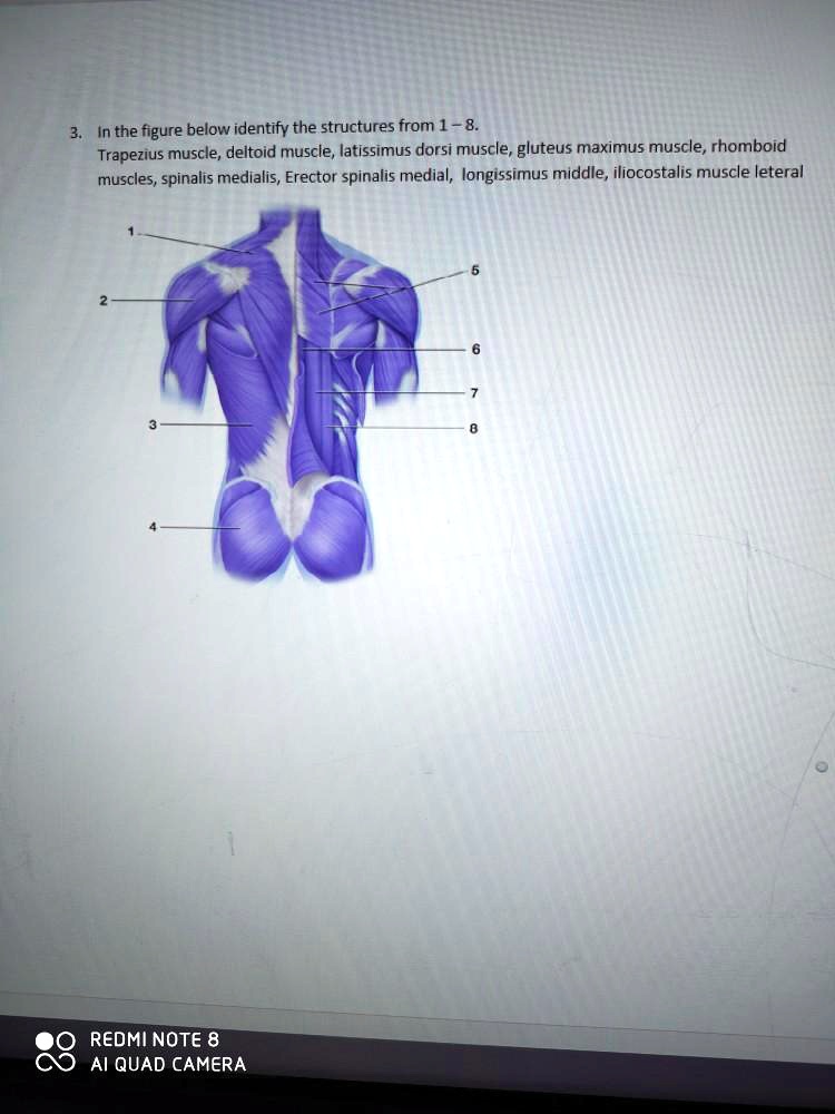 SOLVED In the figure below, identify the structures from 1 Trapezius