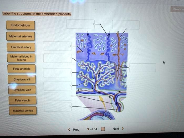 SOLVED: Label the structures of the embedded placenta Endometrium ...