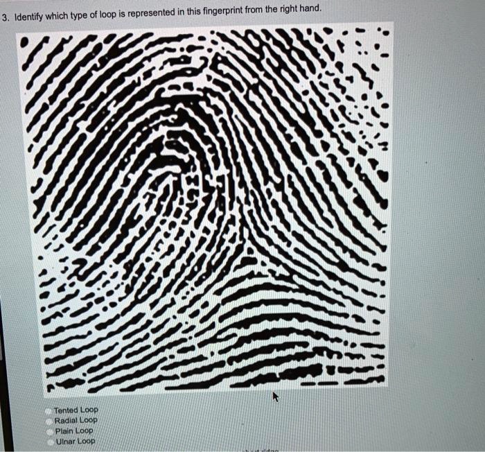 SOLVED: Identify which type of loop is represented in this fingerprint ...