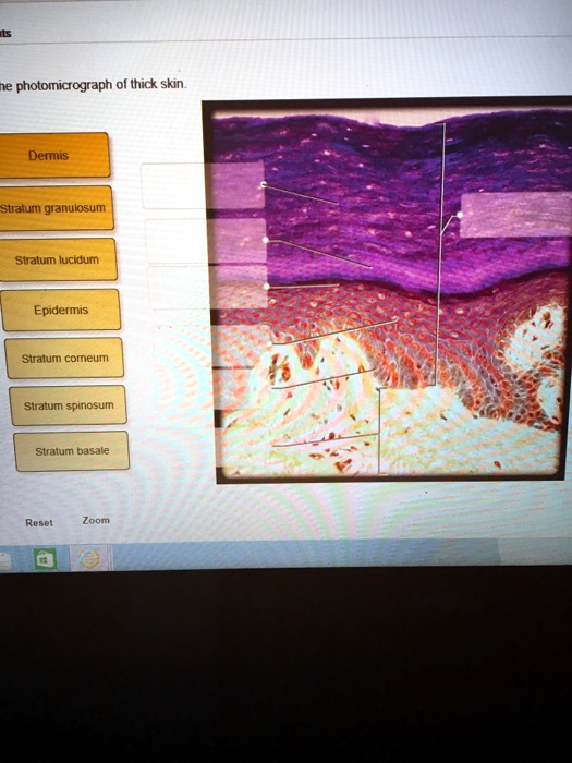 SOLVED:ne photomicrograph of thick skin Dermis Stratum granulosum ...