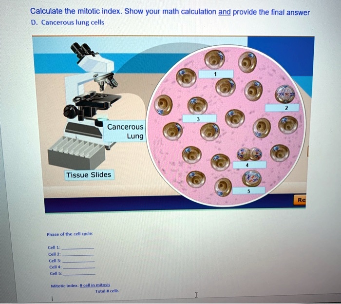 SOLVED: Calculate the mitotic index. Show your math calculation and provide the final answer for ...