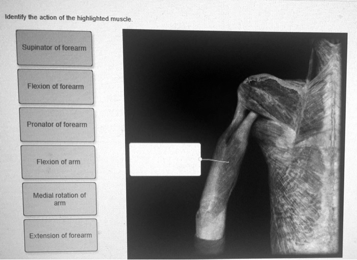 SOLVED Identify the action of the highlighted muscle Supinator of