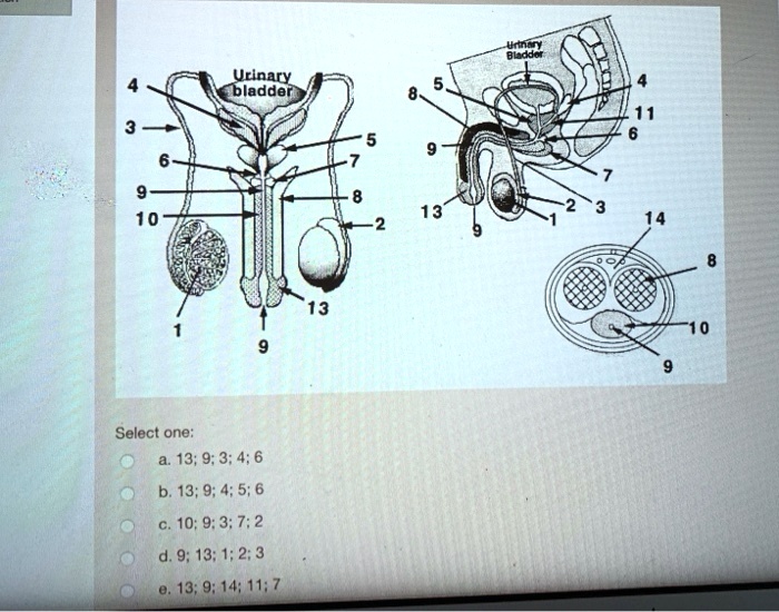 Solved Ucinary Bladder 10 Select One A 13 9 3 4 6 B 13 9 4 5 6 10 9 3 7 2 D 9 13 1 2 3 0 13 9 14 11 7