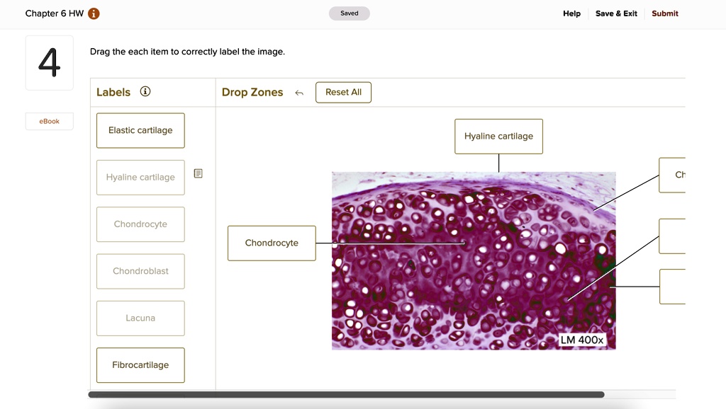 chapter 6 hw saved help save exit submit 4 drag the each item to correctly label the image labels drop zones reset all ebook elastic cartilage hyaline cartilage chondrocyte chondroblast lacu 93049