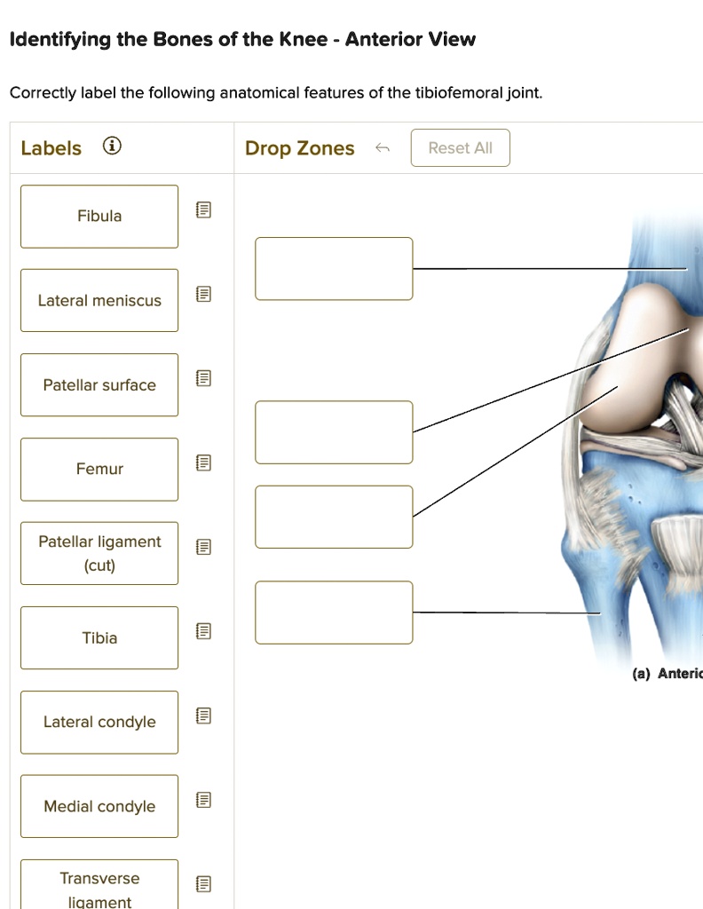Which Of The Following Refers To Fixation Of A Joint Identifying the Bones of the Knee - Anterior View Correctly label the