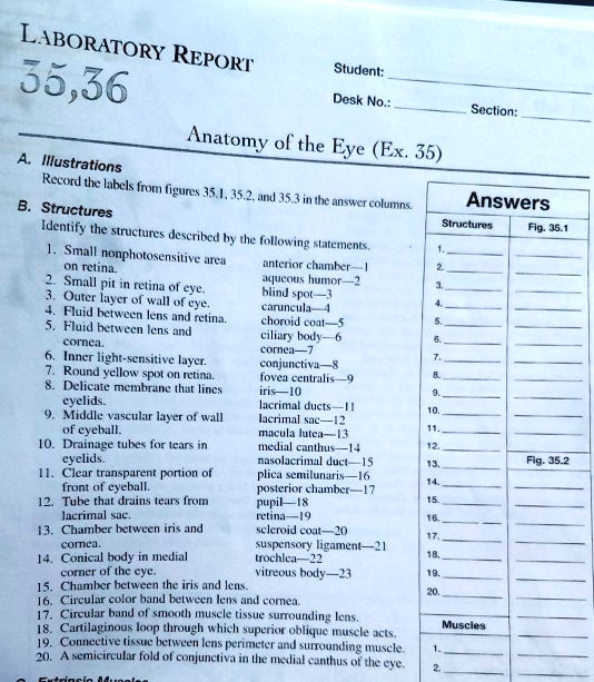 LABORATORY REPORT
35,36
Student:
Desk No.:
Section:
Anatomy of the Eye (Ex. 35)
A. Illustrations
Record the labels from figures 35.1, 35.2, and 35.3 in the answer columns.
B. Structures
Identify the structures described by the following statements.
1. Small nonphotosensitive area on retina.
anterior chamber-1
aqueous humor-2
blind spot-3
caruncula-4
choroid coat-5
ciliary body-6
cornea-7
conjunctiva-8
fovea centralis-9
iris-10
lacrimal ducts-11
lacrimal sac-12
macula lutea-13
medial canthus-14
nasolacrimal duct-15
plica semilunaris-16
posterior chamber-17
pupil-18
retina-19
scleroid coat-20
suspensory ligament-21
trochlea-22
vitreous body-23
2. Small pit in retina of eye.
3. Outer layer of wall of eye.
4. Fluid between lens and retina.
5. Fluid between lens and cornea.
6. Inner light-sensitive layer.
7. Round yellow spot on retina.
8. Delicate membrane that lines eyelids.
9. Middle vascular layer of wall of eyeball.
10. Drainage tubes for tears in eyelids.
11. Clear transparent portion of front of eyeball.
12. Tube that drains tears from lacrimal sac.
13. Chamber between iris and cornea.
14. Conical body in medial corner of the eye.
15. Chamber between the iris and lens.
16. Circular color band between lens and cornea.
17. Circular band of smooth muscle tissue surrounding lens.
18. Cartilaginous loop through which superior oblique muscle acts.
19. Connective tissue between lens perimeter and surrounding muscle.
20. A semicircular fold of conjunctiva in the medial canthus of the eye.
Answers
Structures
Fig. 35.1
1.
2.
3.
4.
5.
6.
7.
8.
9.
10.
11.
12.
Fig. 35.2
13.
14.
15.
16.
17.
18.
19.
20.
Muscles
1.
2.