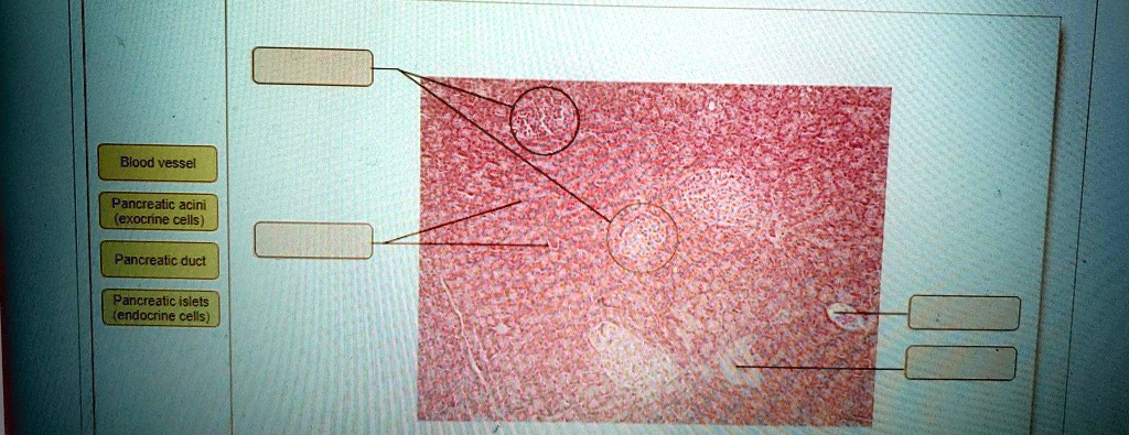 SOLVED: Blood vessel Pancreatic acini (exocrine cells) Pancreatic duct ...