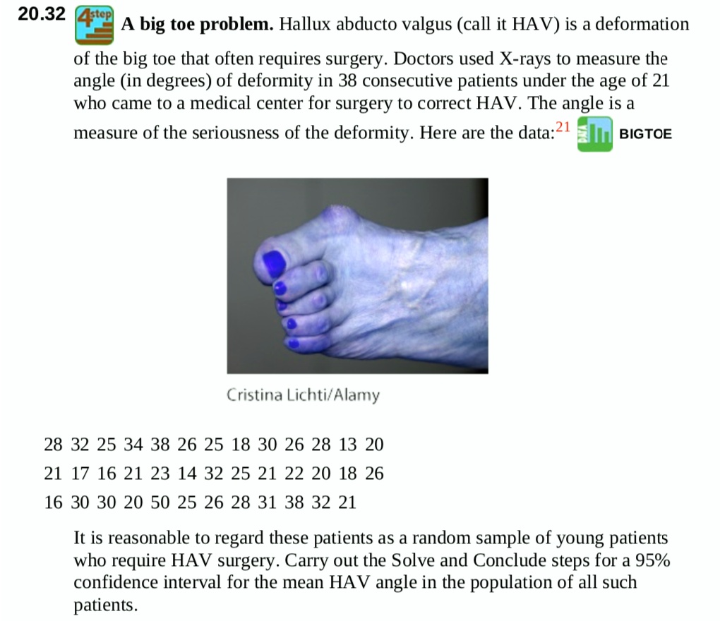 A big toe problem. Hallux abducto valgus (call it HAV) is a deformation of the big toe that often requires surgery. Doctors used X-rays to measure the angle (in degrees) of deformity in 38 consecutive patients under the age of 21 who came to a medical center for surgery to correct HAV. The angle is a measure of the seriousness of the deformity. Here are the data:
28 32 25 34 38 26 25 18 30 26 28 13 20 
21 17 16 21 23 14 32 25 21 22 20 18 26 
16 30 30 20 50 25 26 28 31 38 32 21
It is reasonable to regard these patients as a random sample of young patients who require HAV surgery. Carry out the Solve and Conclude steps for a 95% confidence interval for the mean HAV angle in the population of all such patients.