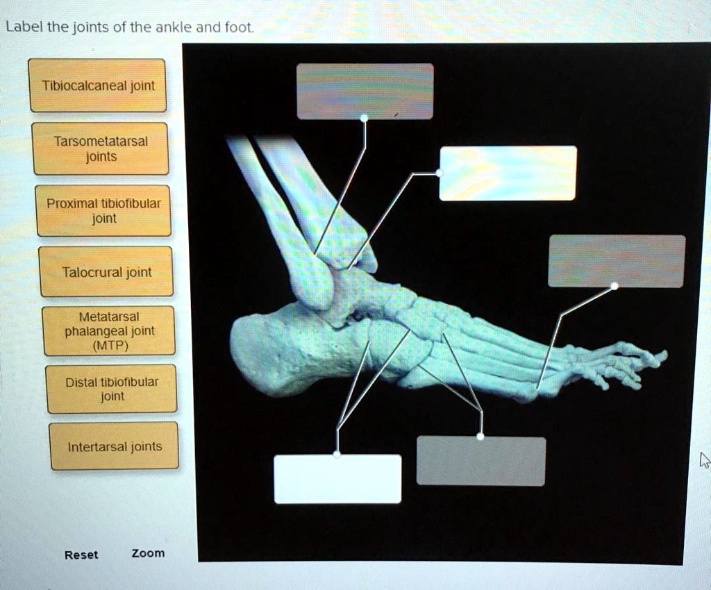 Solved: Label The Joints Of The Ankle And Foot Tibiocalcaneal Joint 