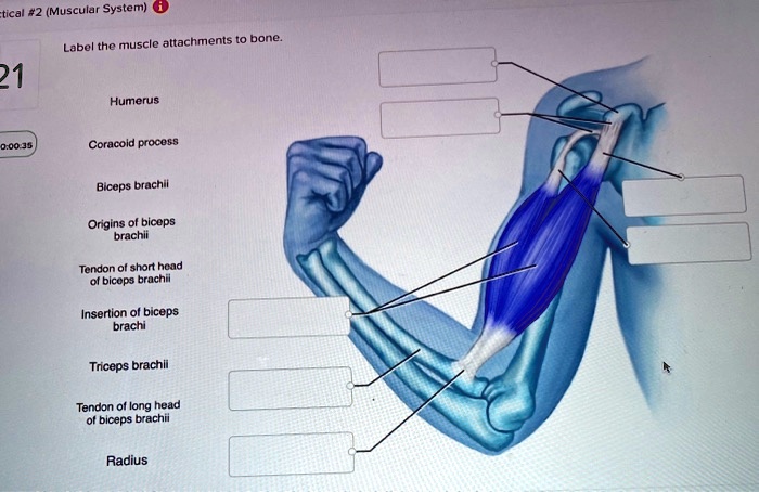 SOLVED: Muscular System: Labeling the Muscle Attachments to Bone 0