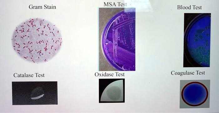 SOLVED: Gram Stain MSA Test Blood Test Catalase Test Oxidase Test ...