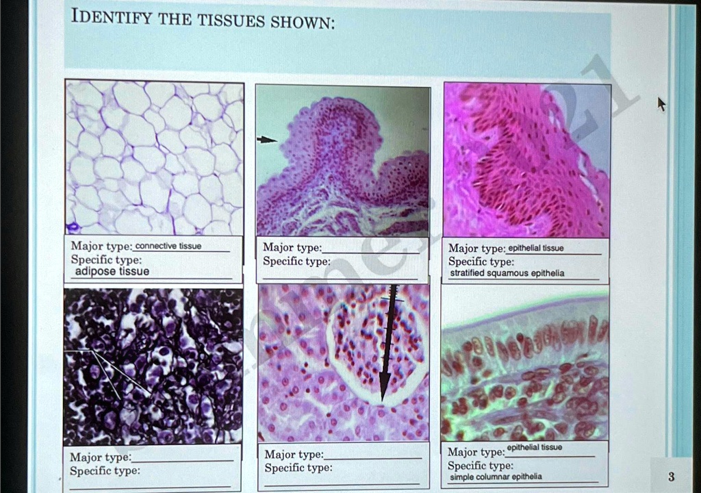 SOLVED: IDENTIFY THE TISSUES SHOWN: Major type: connective tissue ...