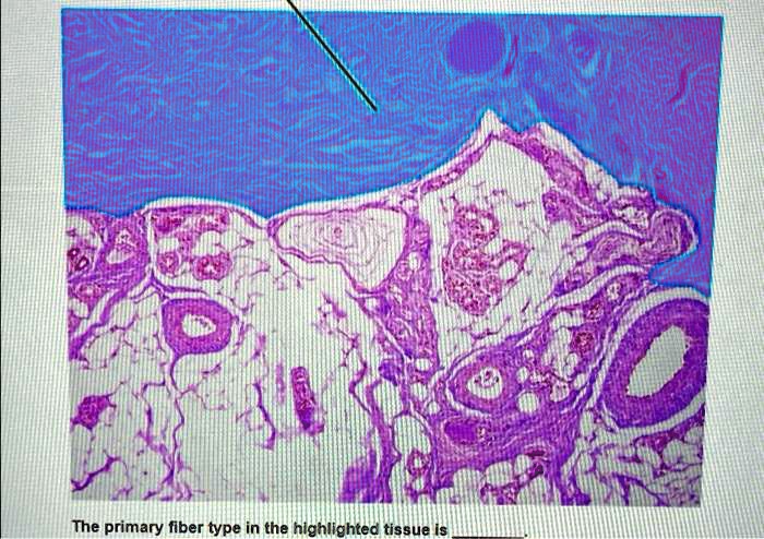 Solved The Primary Fiber Type In The Highlighted Tissue Is