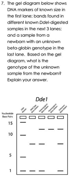 The Gel Diagram Below Shows Dna Markers Of Known Size In The First Lane