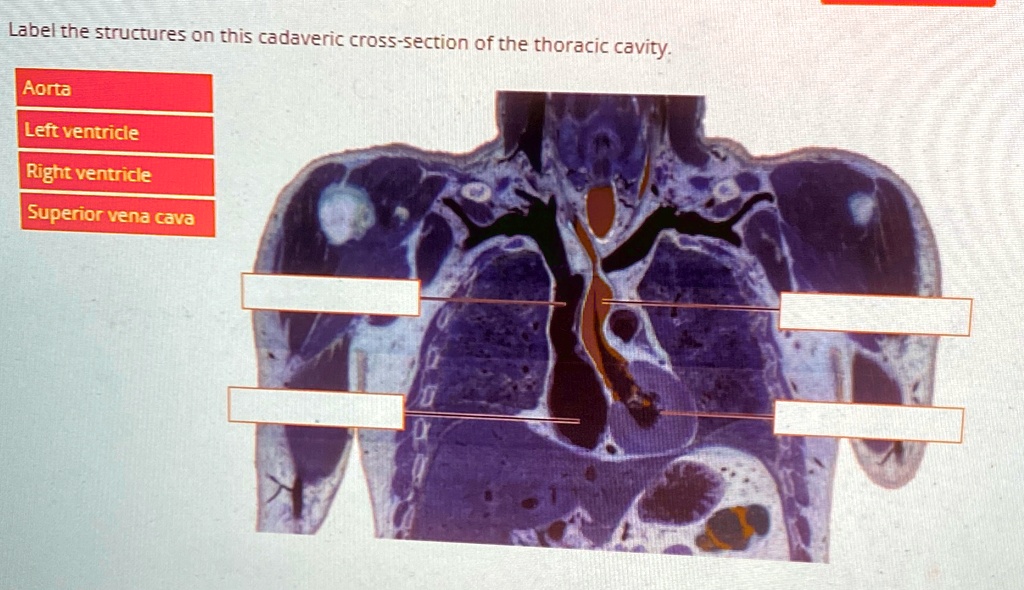 [GET ANSWER] Label the structures on this cadaveric cross-section of ...