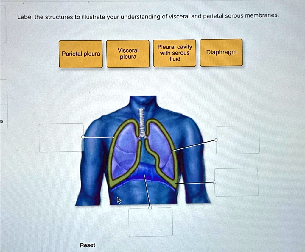 SOLVED: Label the structures to illustrate your understanding of ...