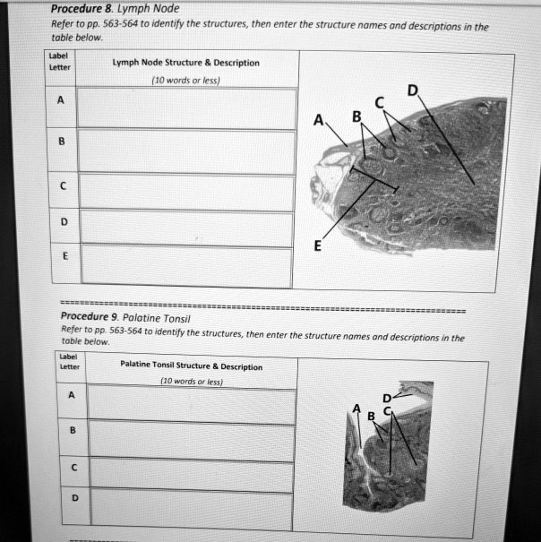 SOLVED: Procedure 8. Lymph Node Refer t0 pp. 563-564 t0 identify the ...