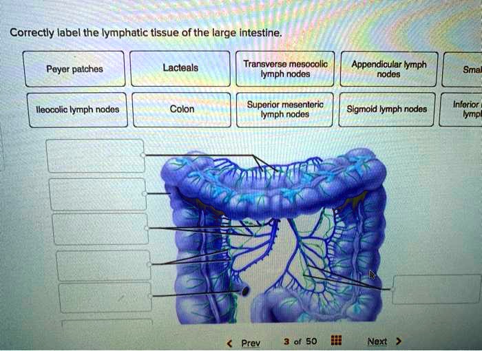 SOLVED: Correctly label the lymphatic tissue of the large intestine ...