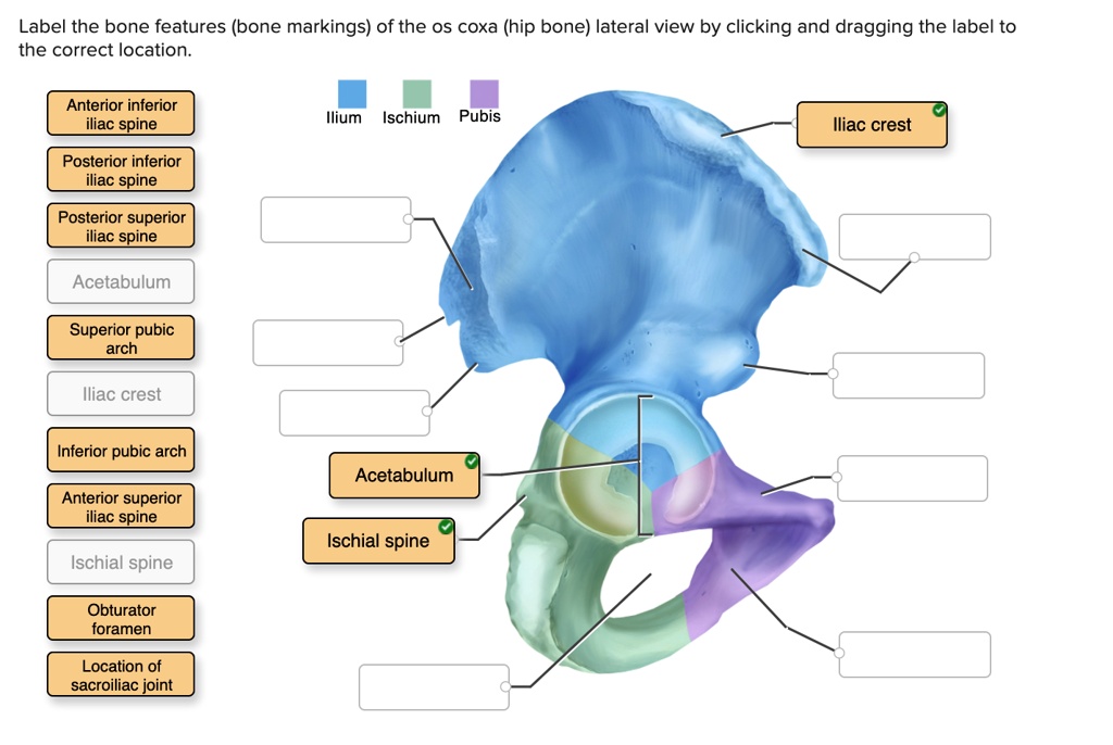 SOLVED: Label the bone features (bone markings) of the os coxa (hip ...
