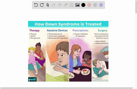 what-are-the-treatment-plan-for-trisomy-21-63384