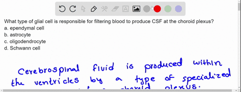 what-type-of-glial-cell-is-responsible-for-filtering-blood-to-produce-csf-at-the-choroid-plexus-a-ep-32794