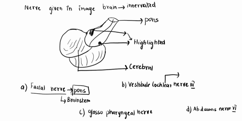 li-crn2-part-38-s-which-cranial-nerve-is-highlighted-facial-nervevii-vestibulocochlear-nerve-vii-glossopharyngeal-nerveix-abducens-nerve-vi-83295