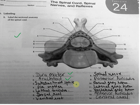 the-spinal-cordspinal-nervesand-reflexes-exercise-24-date-section-labeling-1label-the-sectional-anatomy-of-the-spinal-cord-dora-mater-araunnoid-3-bposteriortuniculus-10-11-5-2-antericr-tunic-24894