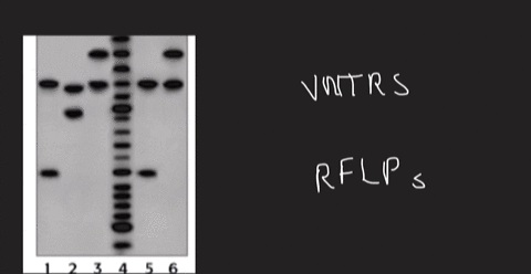 examine-the-gel-from-rape-investigation-below-if-you-were-the-dna-analyst-you-would-conclude-that-dna-size-markers-blood-sexusl-sumples-jssault-evidence-victim-suspect-female-traction-isuspe-99239