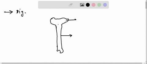medial-malleolus-tibial-tuberosity-lateral-condyle-medial-condyle-anterior-border-35097